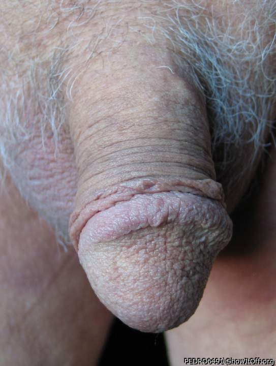 My Head