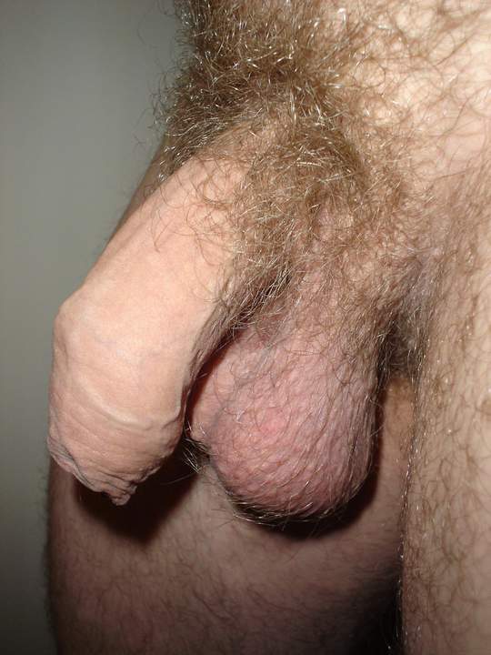 hairy