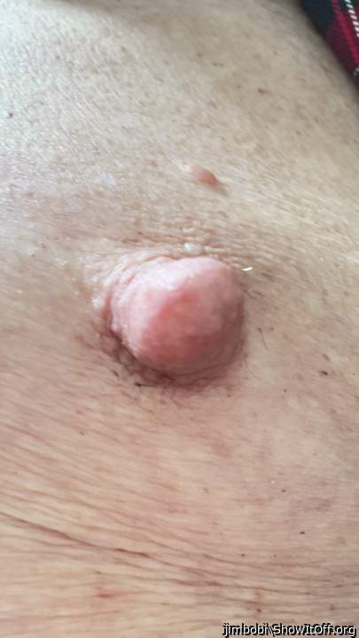 Photo of a penile from jimbobi