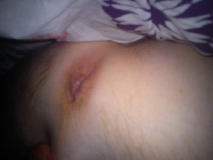 Looks like a tight hole
