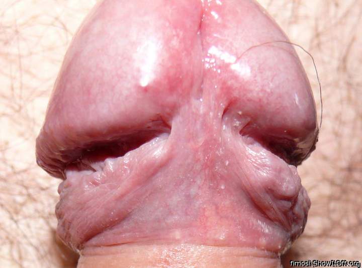 My frenulum...