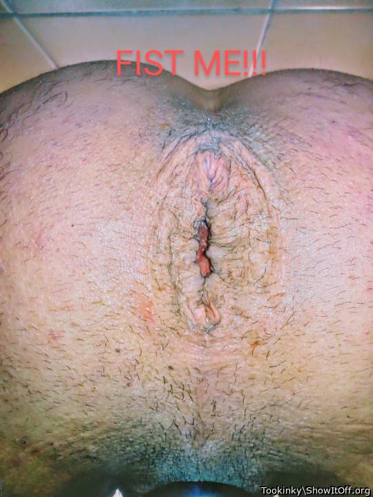 My asshole after self fisting