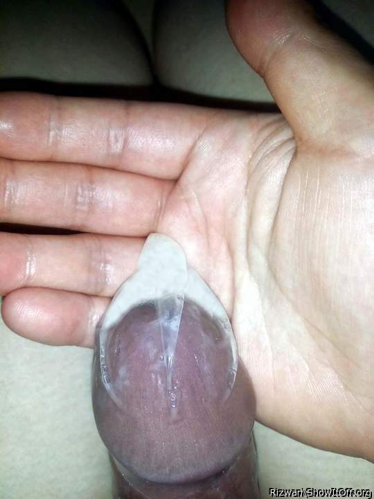 Photo of a short leg from Rizwan