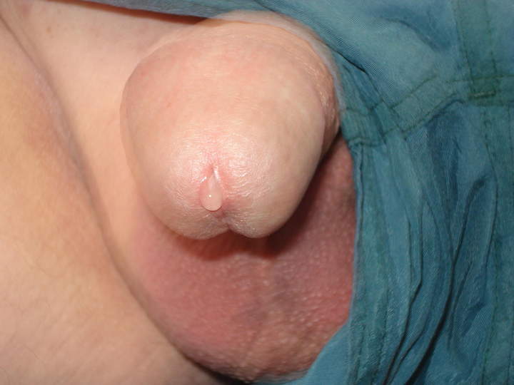 Photo of a stiffie from cocki1