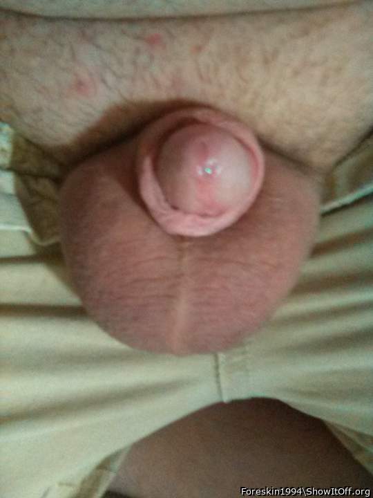 Photo of a rooster from Foreskin1994