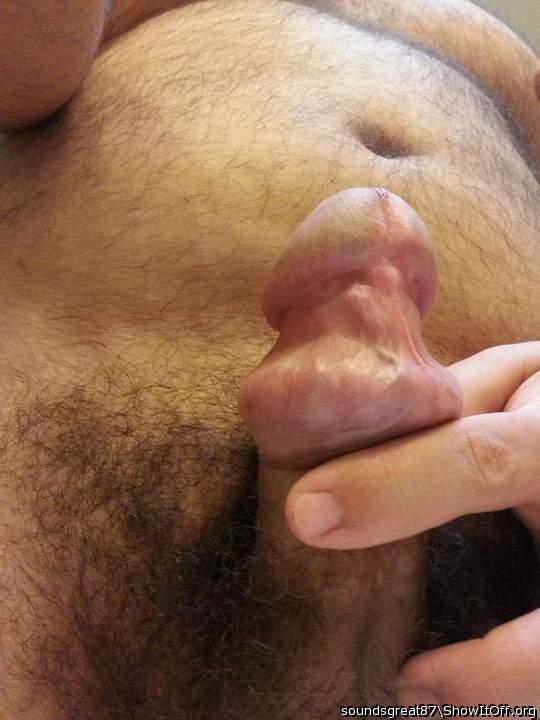 Foreskin rolled back over cockring