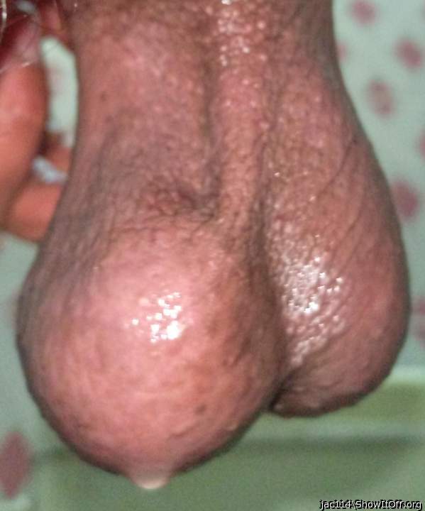 My left ball is swollen