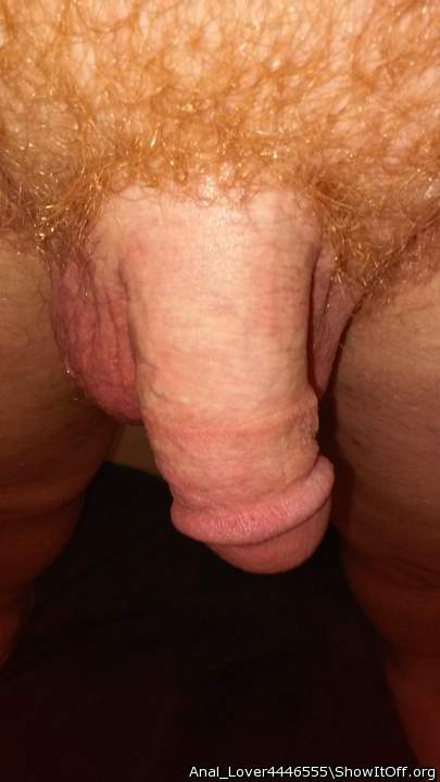 Photo of a private part from Anal_Lover4446555