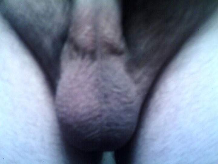 Testicles Photo from sdalex