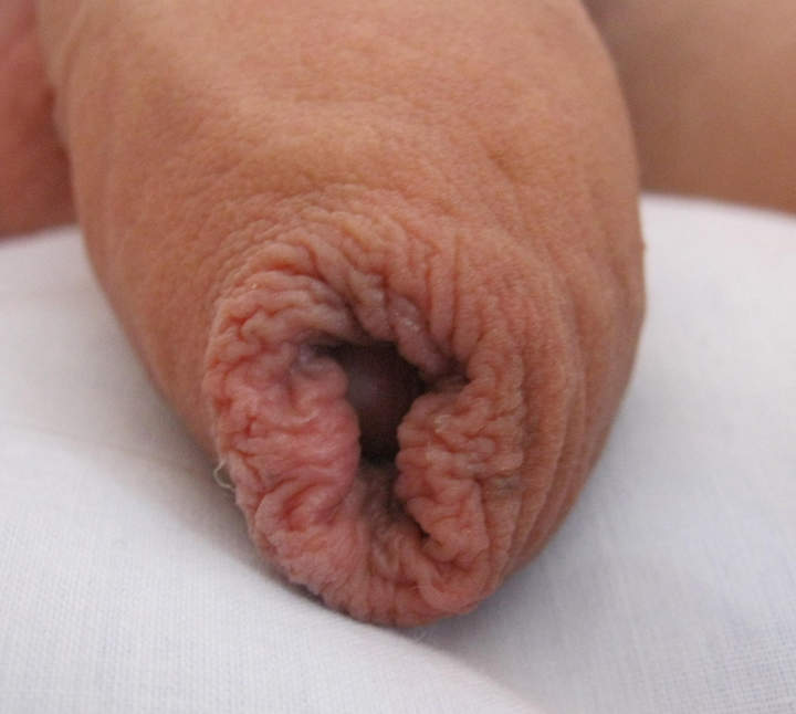 great foreskin 