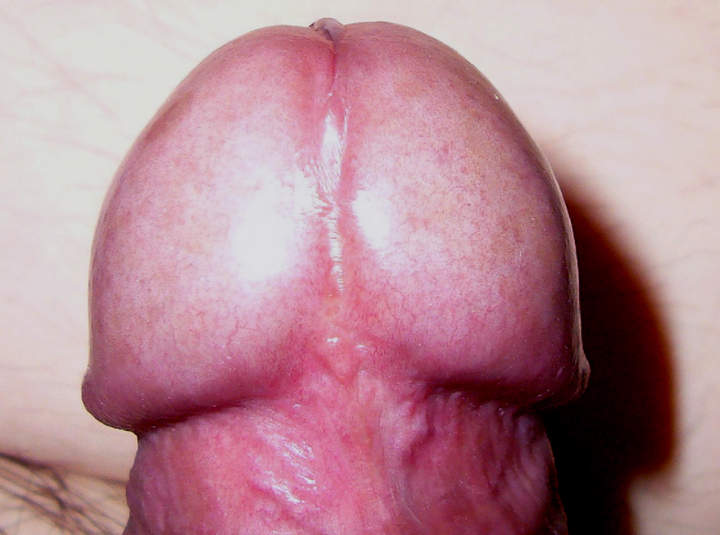 Alien's Head