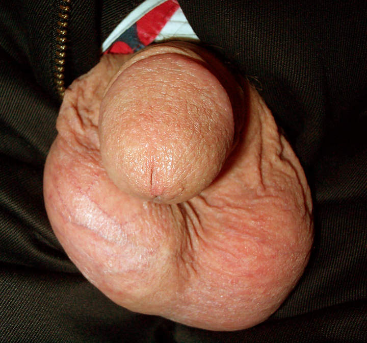 Photo of a phallus from lilsoftee