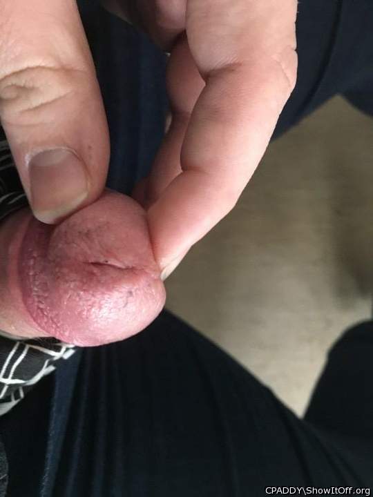 My Circumcised Dick-Do you like it?