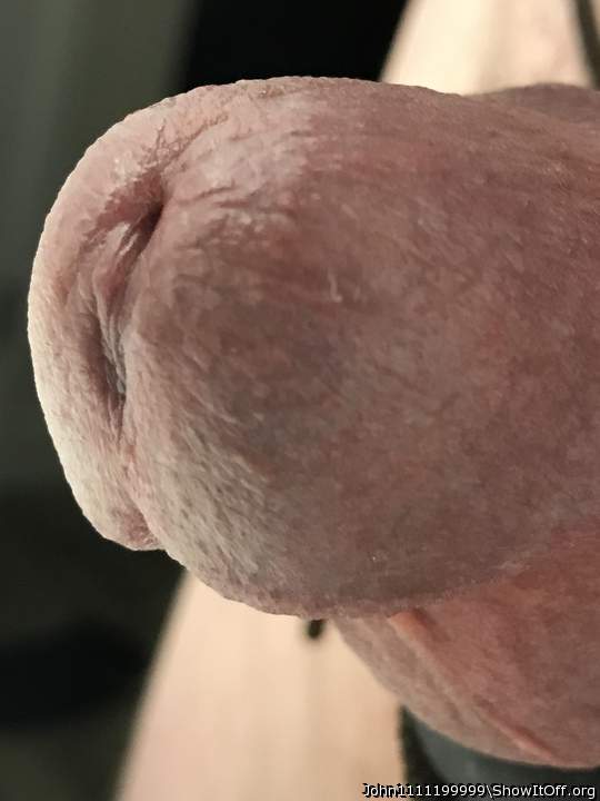 Photo of a private part from John1111199999