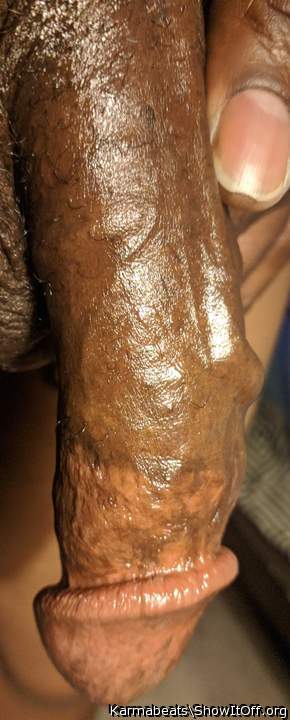 Photo of a middle leg from Karmabeats
