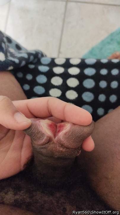 Spreading
