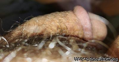 Photo of a prick from M*C*S