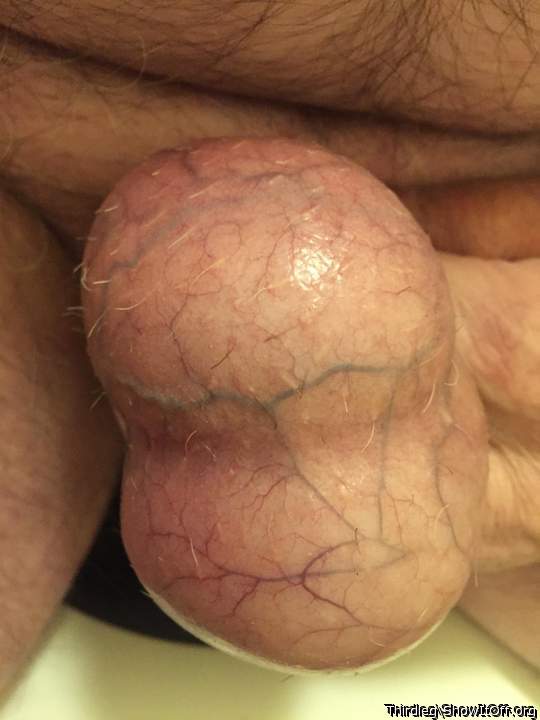 My eggs