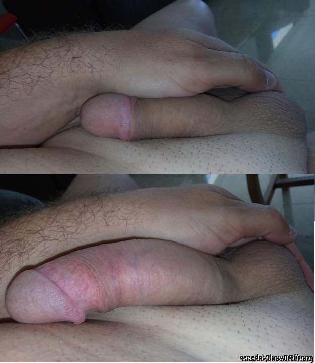 Photo of a short leg from casado