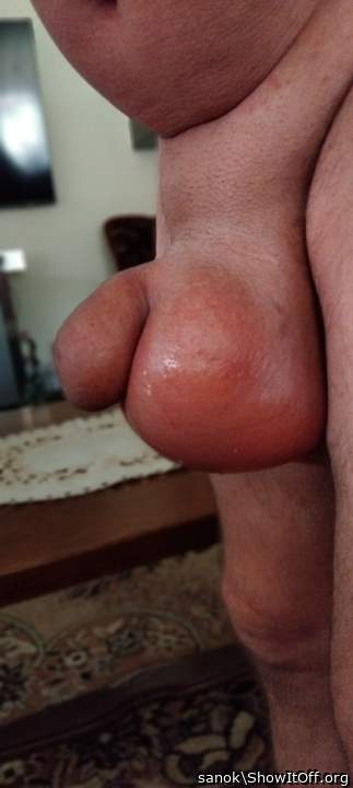 Testicles Photo from sanok