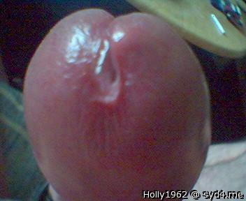Photo of a short leg from Holly1962