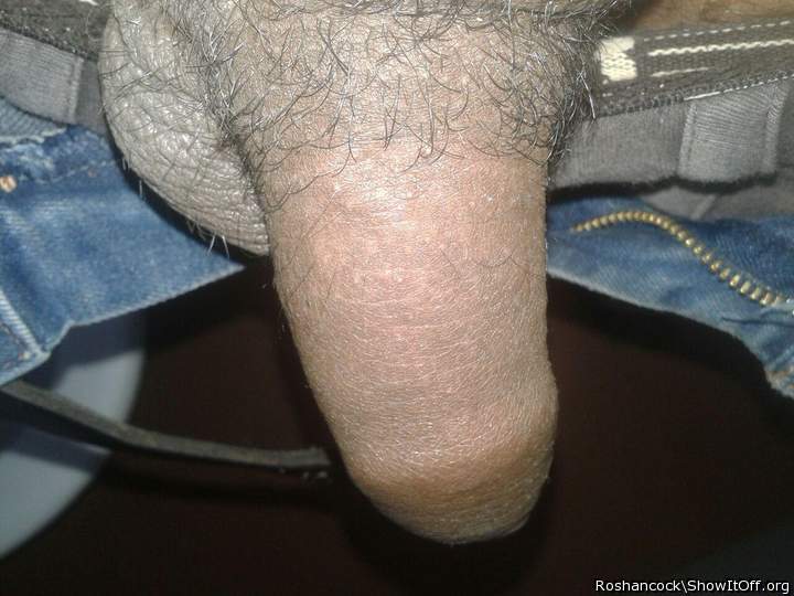 Photo of a bald-headed mouse from roshancock