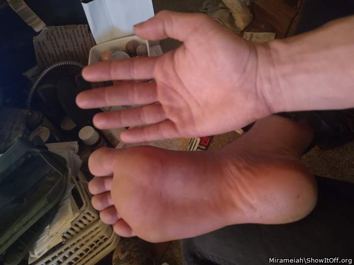 My hand compared to my foot.