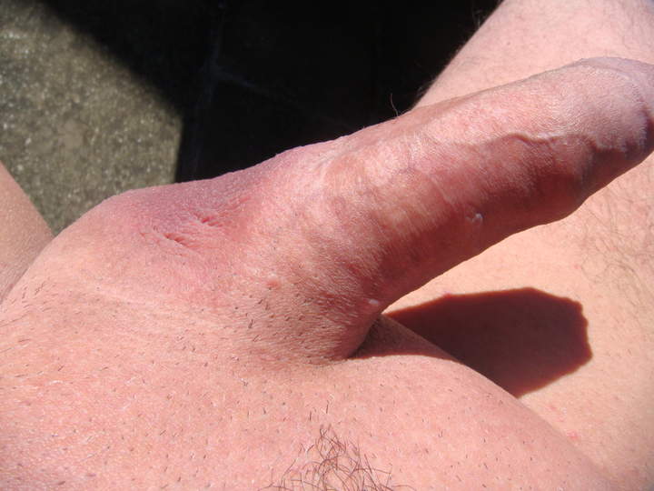 Photo of a middle leg from sivad666