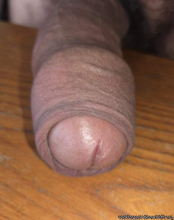 When h's hard, his foreskin is too short to cover his head