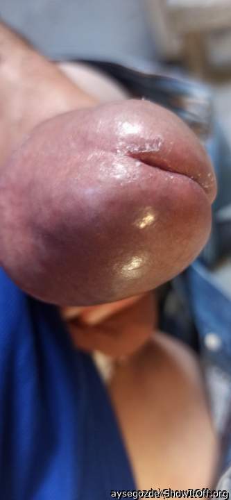 Testicles Photo from aysegozde