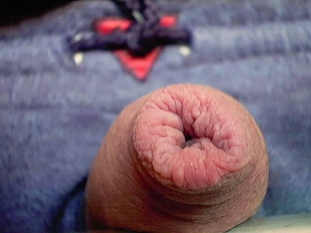 Up Close