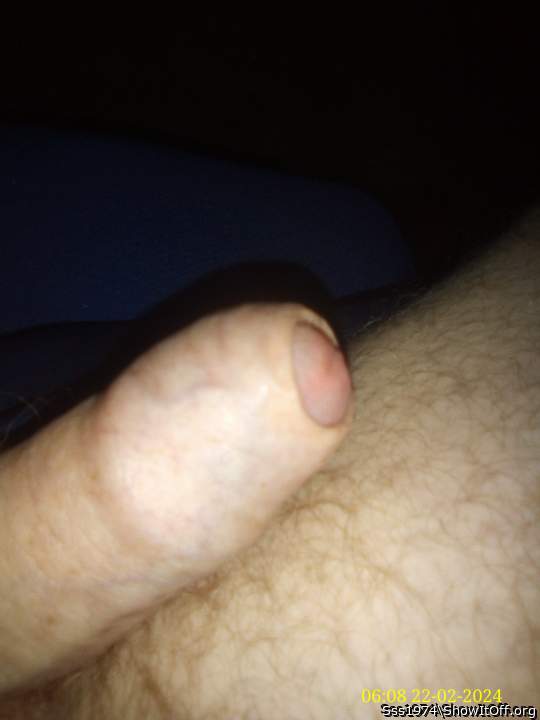 Photo of a middle leg from Sss1974