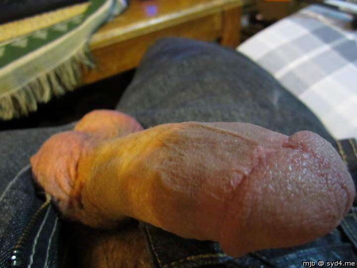 Photo of a bald-headed mouse from mjb