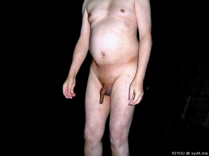 long foreskin