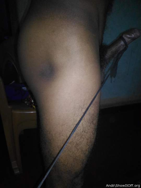 Photo of a prick from Andii