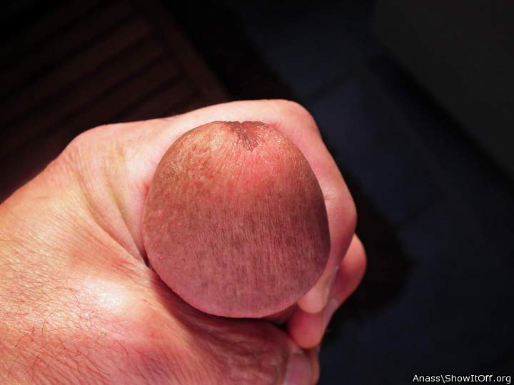 Photo of a private part from Anass
