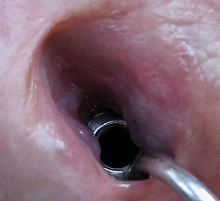 deep inside view
