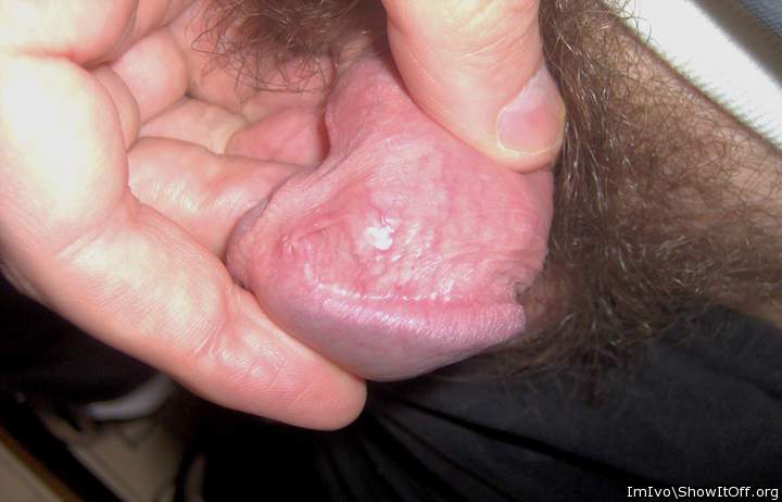 Nude glans with corona and retracted foreskin (extreme closeup)