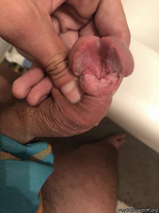 every time I look at my penis