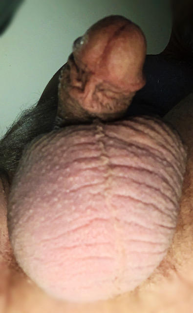Photo of a prick from greeny13