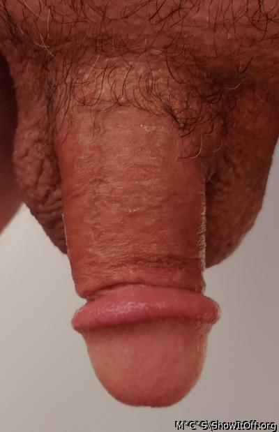 Photo of a penile from M*C*S