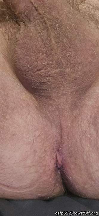 Photo of a penile from gsfp65