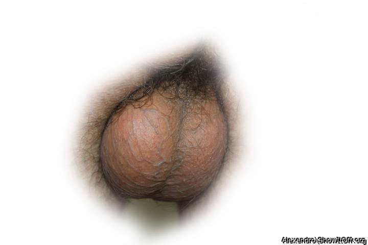 My beautiful balls!!!!