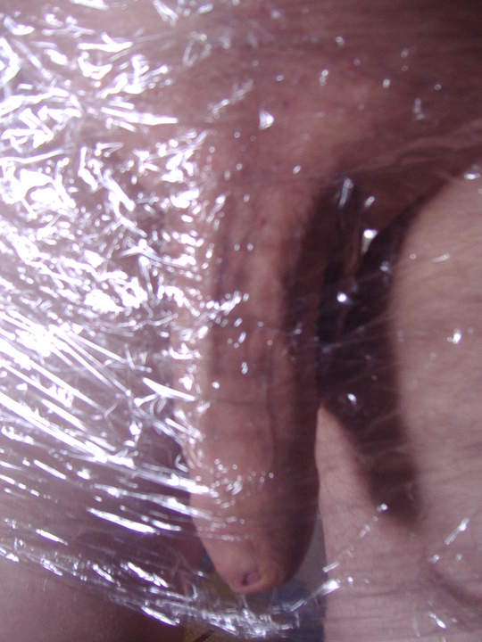 Photo of a private part from stecher