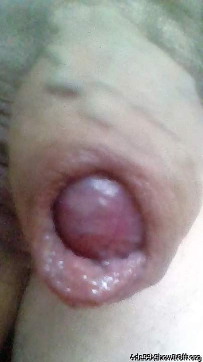 Photo of a prick from Ade59