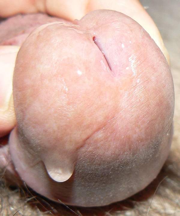 precum is dripping
