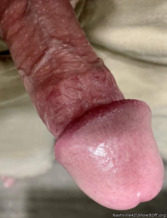 Beautiful glans !! 