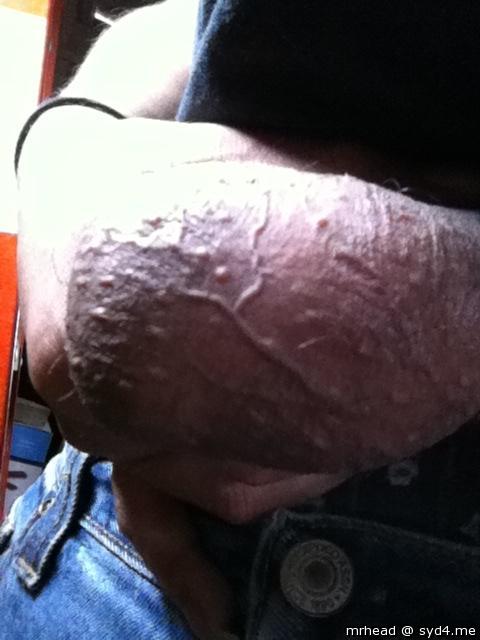 Who wants big balls