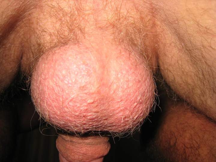 Can I kiss your nuts?
