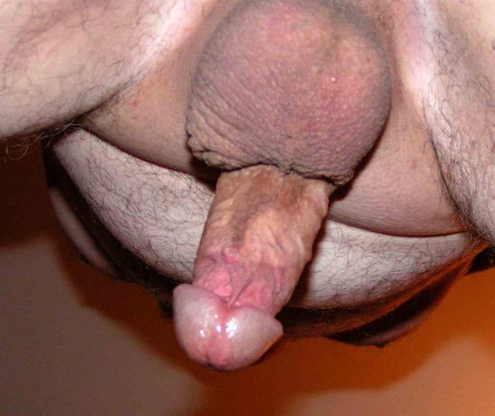 Thanks. If you would like to have a live view and you can ge